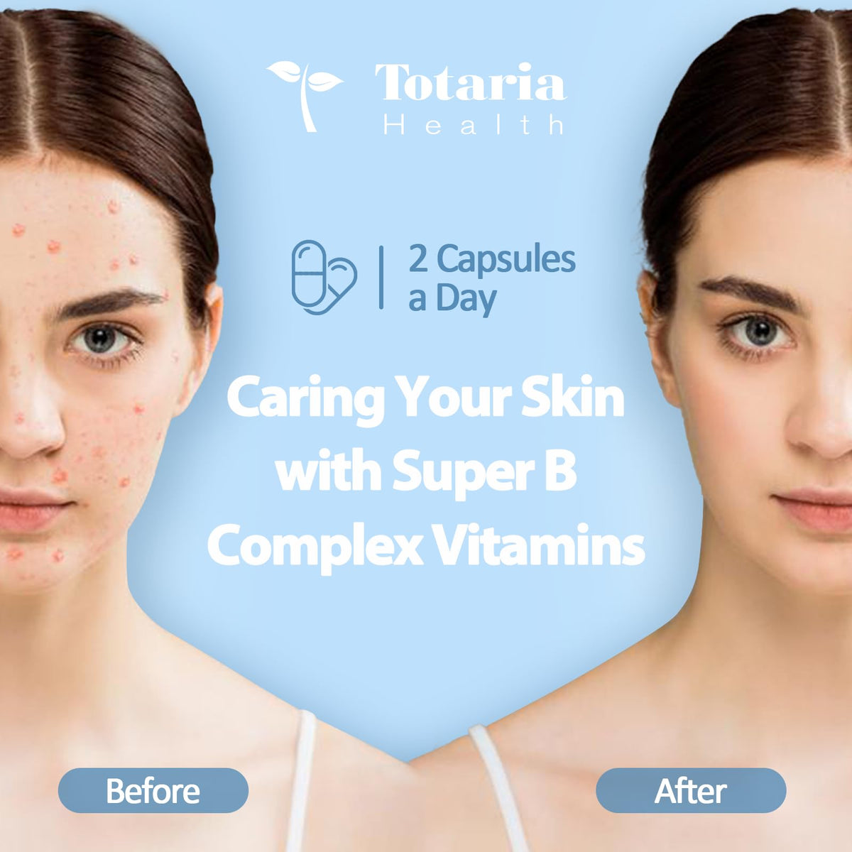 13-in-1 Vitamin B Complex Plus with Vitamin B1, B2, B3 (Niacinamide), B4, B5, B6, B7 (Biotin), B8 (Inositol), B9 (Folate), B12, C, D3, K2 - Energy, Nerve, - Maple Wellness Supplements