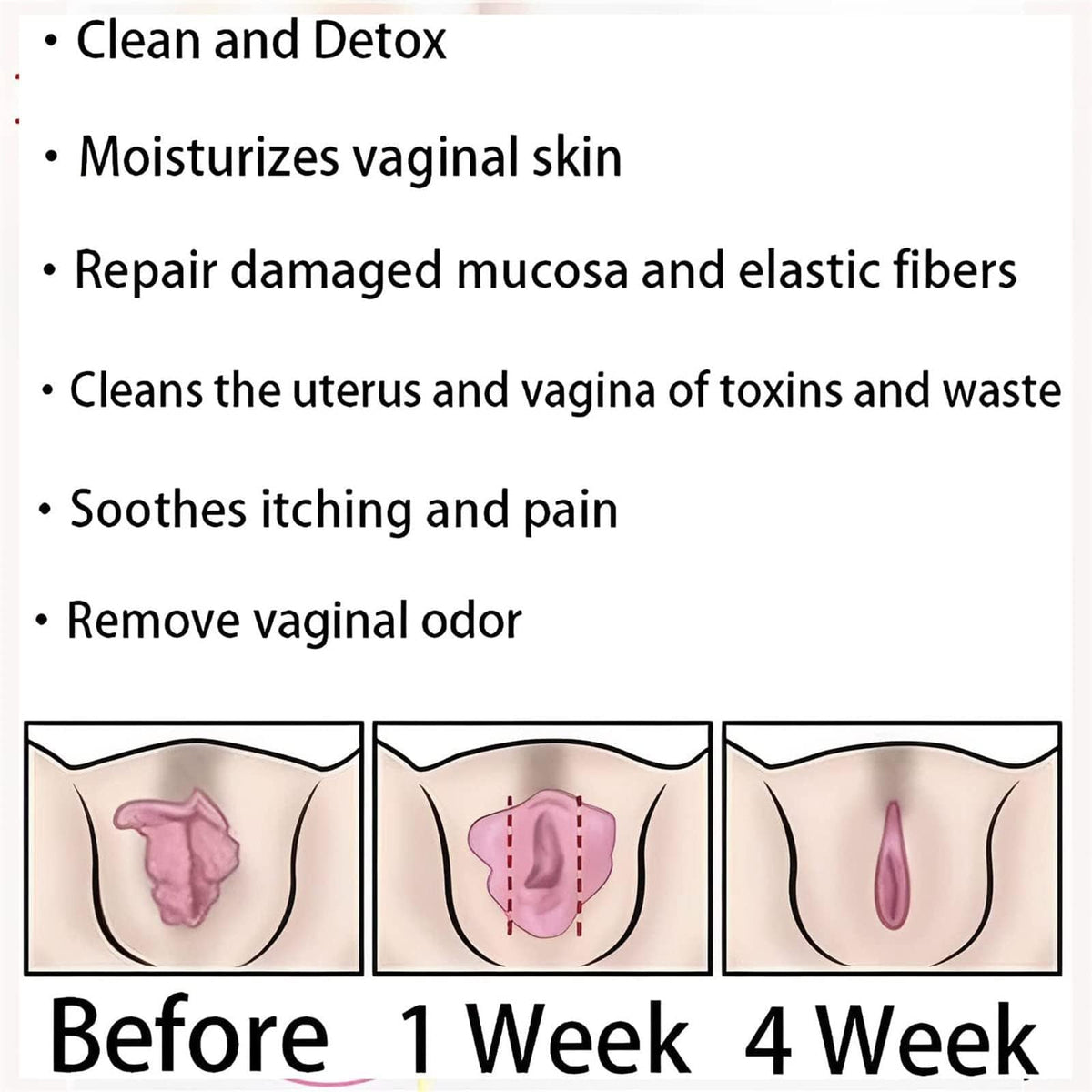 Dexcara Detox Repair, AnnieCare Natural Repair Vaginal Capsules, Anniecare Instant Anti YeeKeniOBuy Supplements Australia