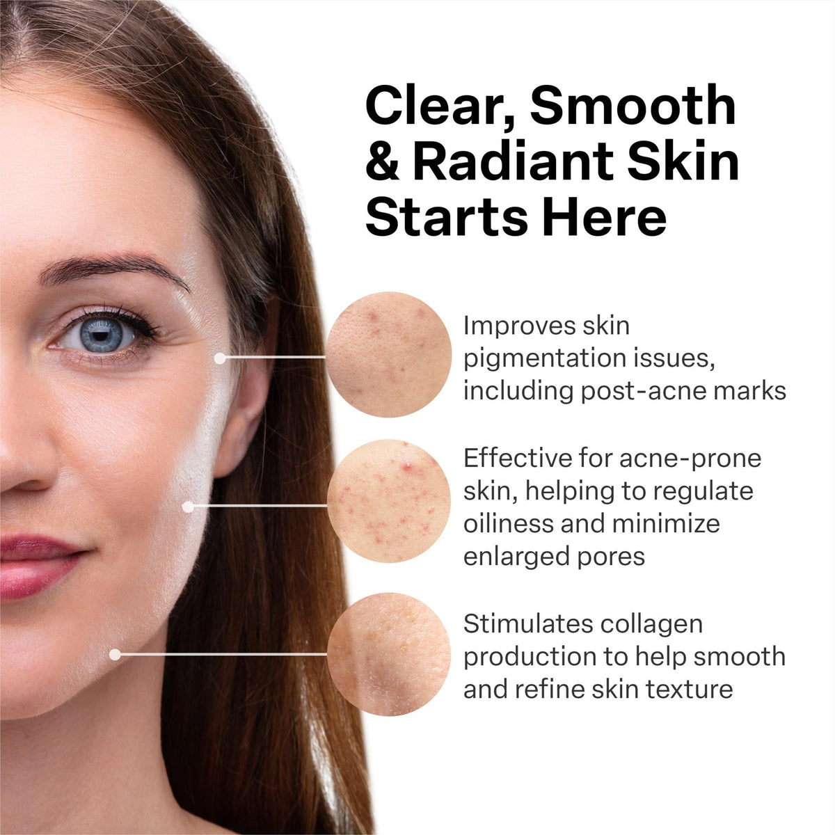 A313 French Pharmacy Vitamin A (Retinoids) Lightweight Face Cream for Anti-Aging, Reduce Wrinkles, Prevents Acne Breakouts - Maple Wellness Supplements