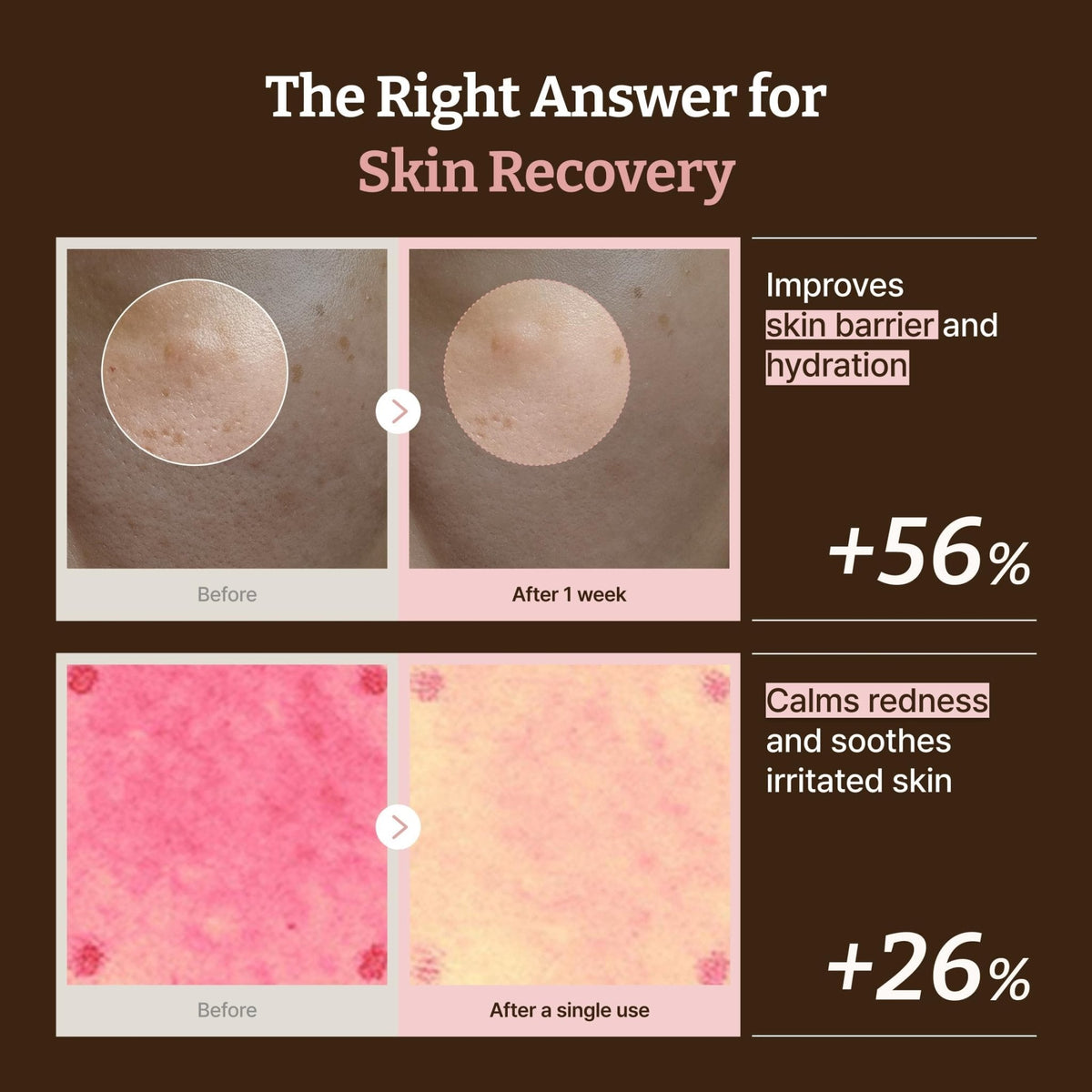 Dr.Reju-All PDRN All-Day Glow Duo: Advanced PDRN Rejuvenating Cream + Advanced PDRN Rejuvenating Mask - Face Moisturizer & Facial Mask for Hydration & Plumping - Korean Skin Care Daily Routine - Maple Wellness Supplements
