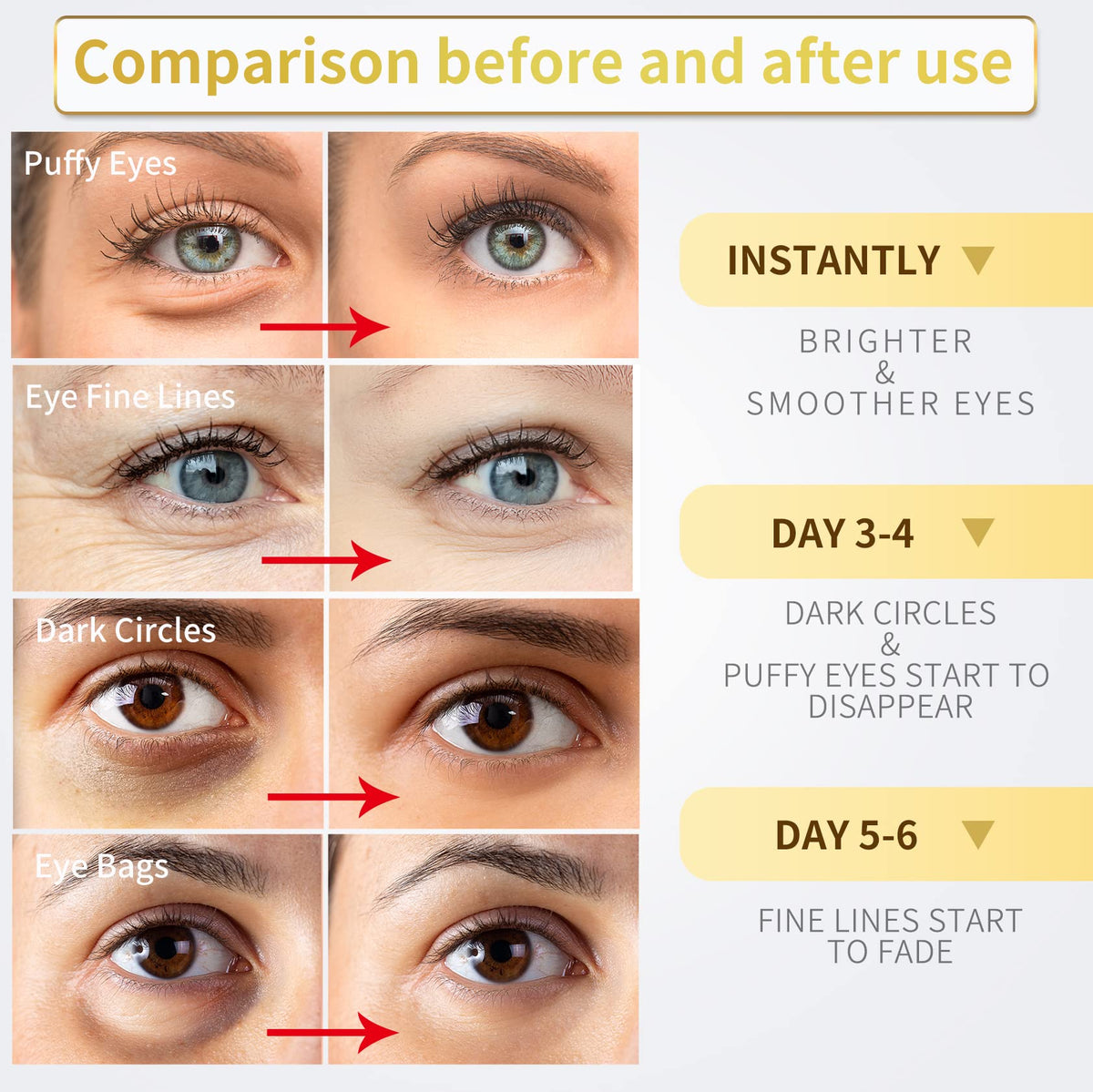 NAZANO 24K Gold Under Eye Patches - 60 Pack for Puffy Eyes, Dark Circles, Bags & Wrinkles - Maple Wellness Supplements