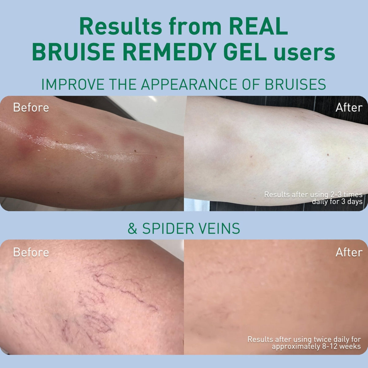 PROcure Arnica & MSM Bruise Remedy Gel – Paraben-Free, Unscented Arnica Montana Gel for Bruising, Spider Veins & Skin Discoloration – 2 Pack - Maple Wellness Supplements