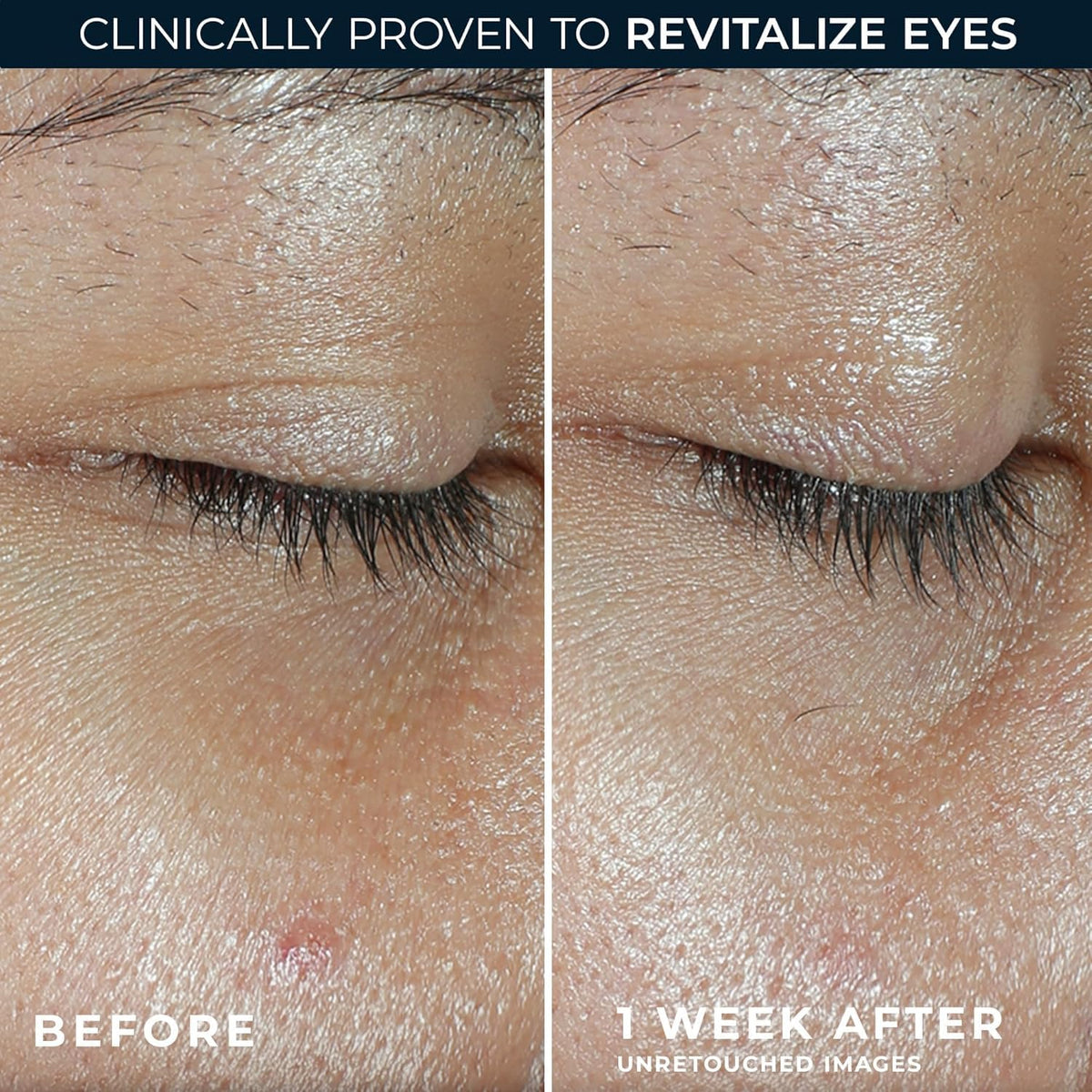 RoC Multi Correxion Revive + Glow Eye Balm with Vitamin C (0.14 oz) + Retinol Eye Cream Packette - Maple Wellness Supplements