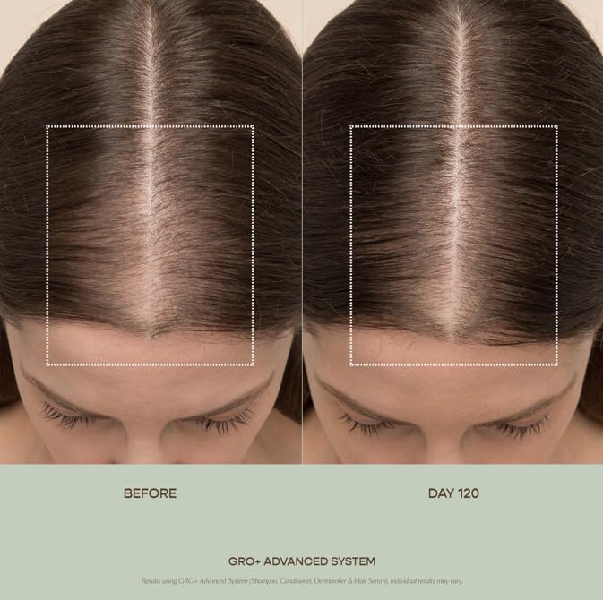 VEGAMOUR GRO+ Advanced Hair Serum for Improving Hair Density, Tonic Reduces Shedding and Promotes a Healthy Scalp, 3 pack - Maple Wellness Supplements