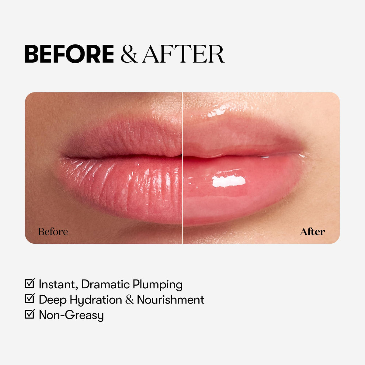 VTCOSMETICS Reedle Shot Lip Plumper, 0.15 oz (4.3 g), Moisturizing, Transparent, Lip Gloss, Fragrance-free, Korean Cosmetics (Expert) - Maple Wellness Supplements