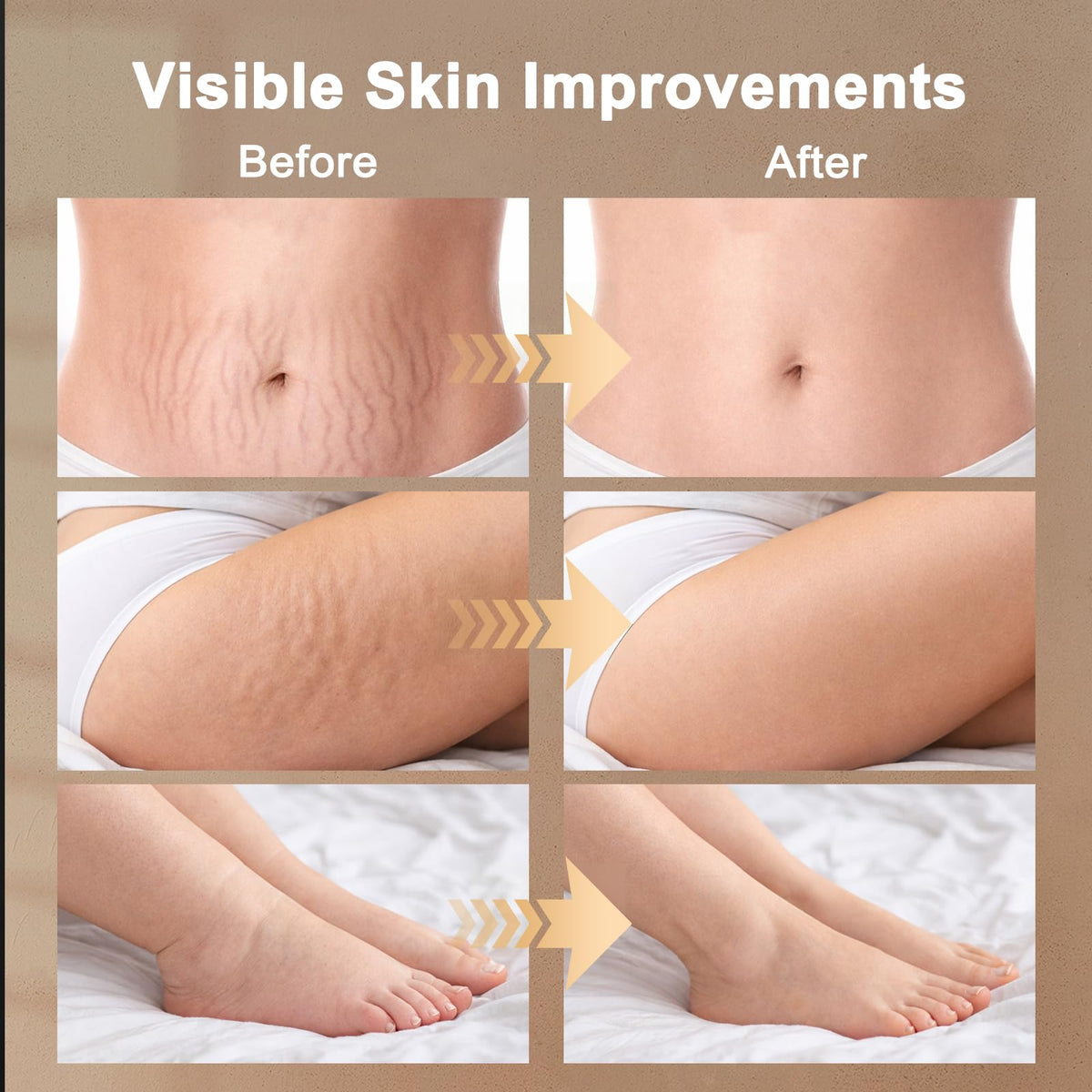ZRCZRC Lymphatic Drainage Massager, Lymphatic Massager, Helps Reduce Stretch Marks & Cellulite, for Legs, Arms & Belly, Body Sculpting Machine with Microcurrent, Light, Heat & Vibration, White - Maple Wellness Supplements